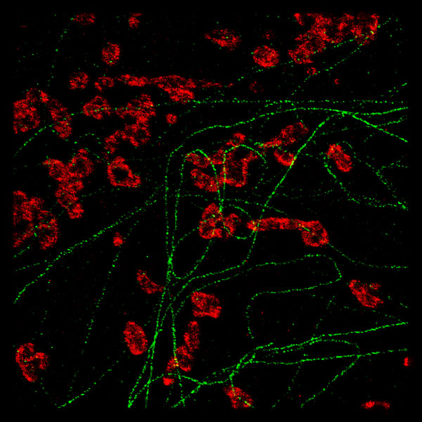 使用wnsr威尼斯642和532纳米激光器的基态耗尽显微术